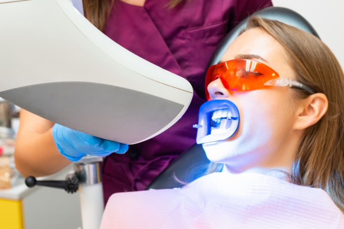 How Long Does Teeth Whitening Last?