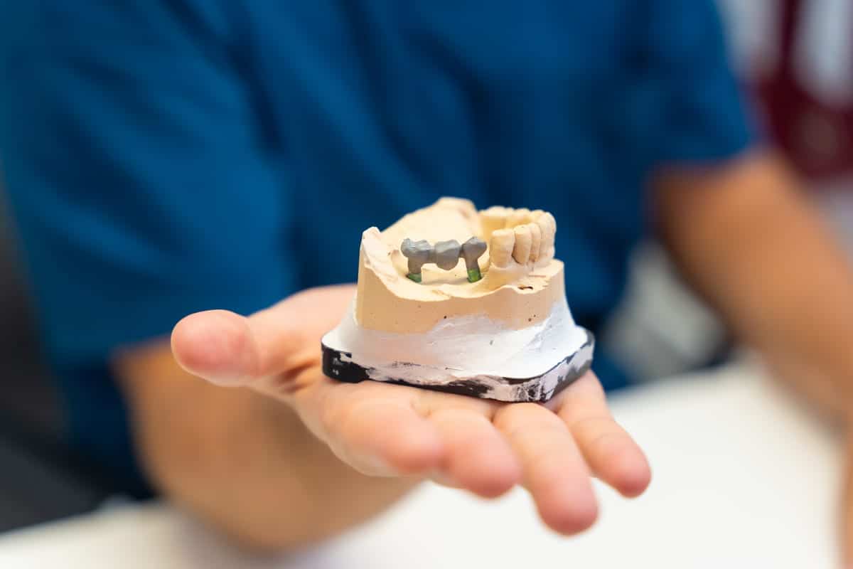 Dental Crowns in Hutto