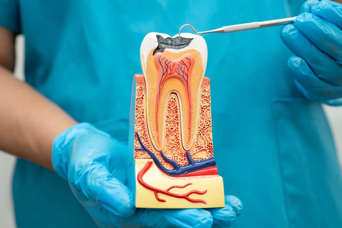 Root Canal Treatment in Hutto