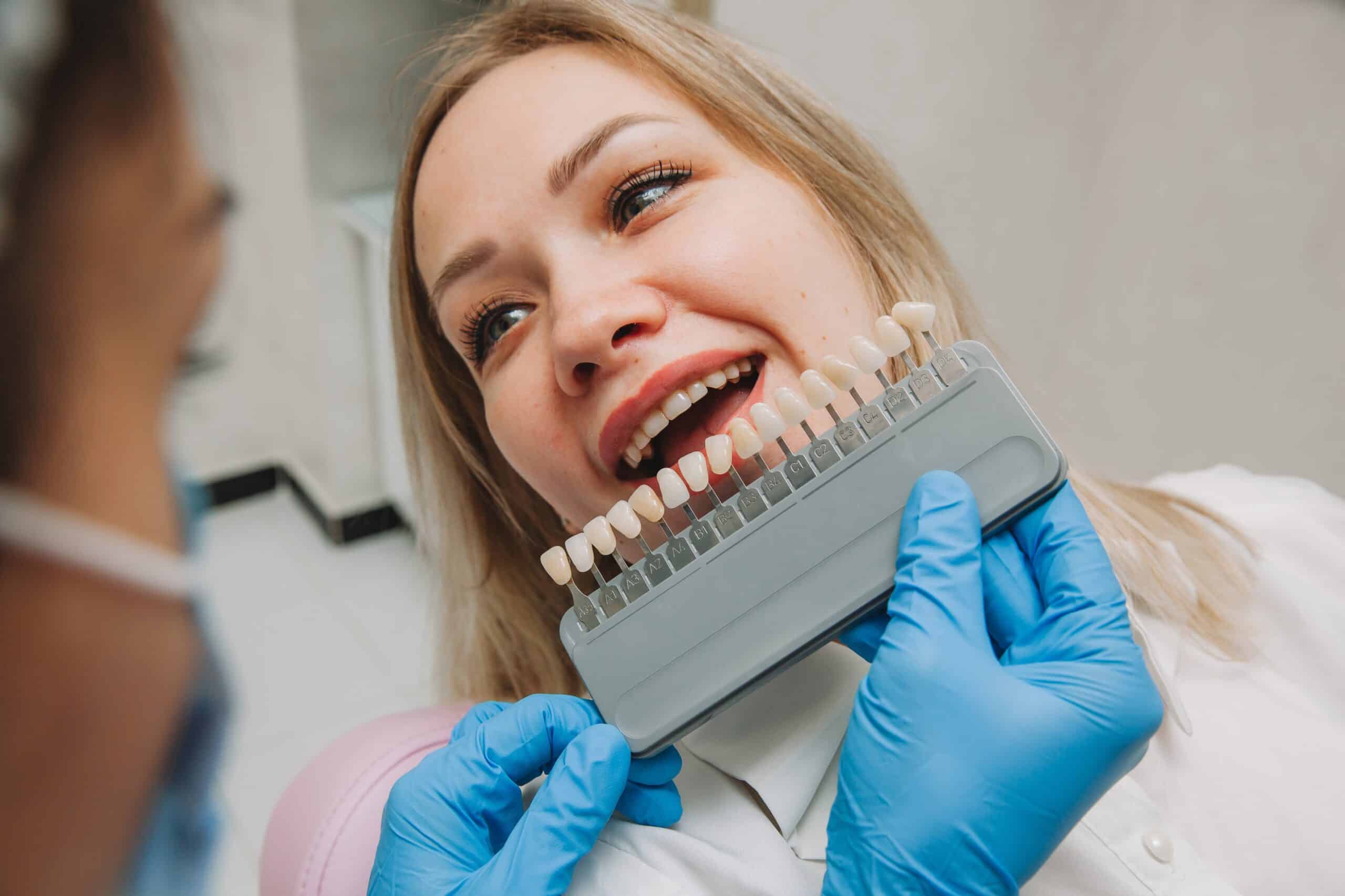 Veneers in Hutto