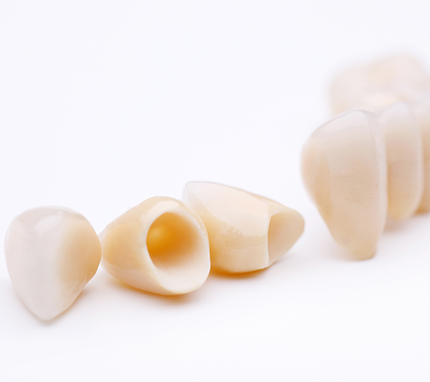 Hutto Dental Crowns and Dental Bridges